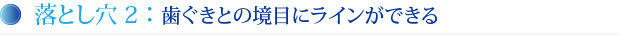 落とし穴2：　歯ぐきとの境目にラインができる