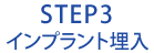 STEP3インプラント埋入