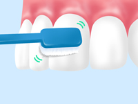 歯みがきに自信のない方