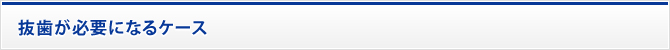 抜歯が必要になるケース