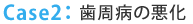 Case2：歯周病の悪化