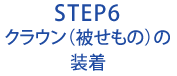 STEP6 クラウン（被せもの）の装着